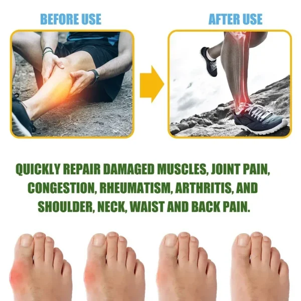 Spray de aceite para artralgia reumática, calmante para el dolor muscular, disipación de grasa - Imagen 3