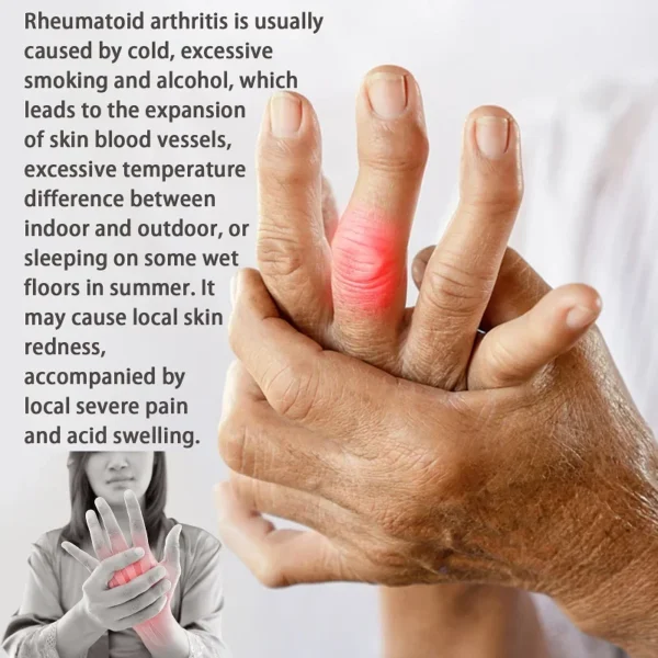 Spray de aceite para artralgia reumática, calmante para el dolor muscular, disipación de grasa - Imagen 5